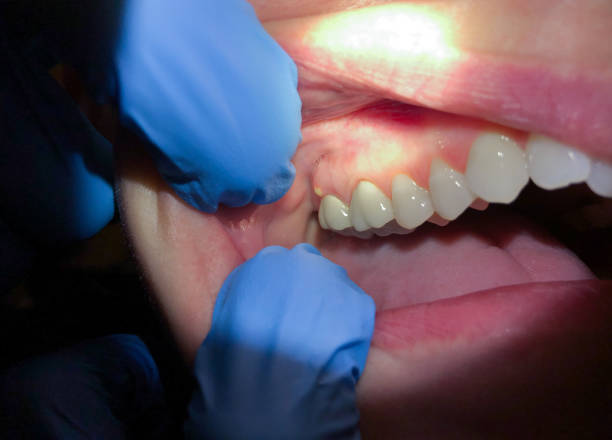 Best Broken or Cracked Tooth Emergency Dentist in Nahunta, GA