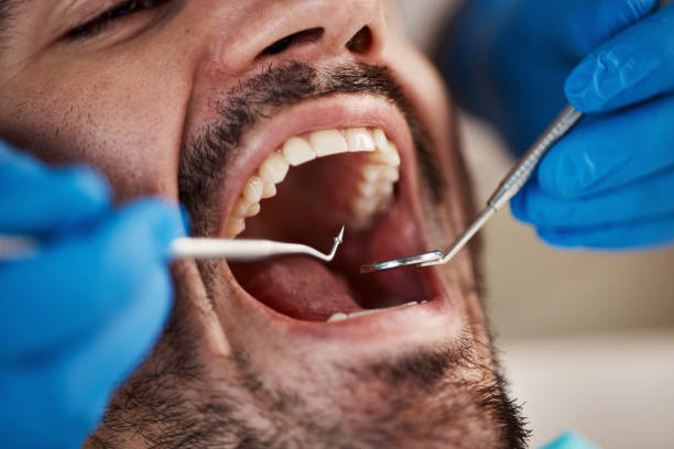 Best Emergency Dental Care for Abscessed Tooth in Nahunta, GA